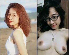 Cirurgia para duas meninas jovens que foram atingidas por um branco saudável na vagina